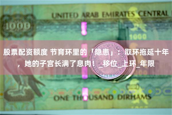 股票配资额度 节育环里的「隐患」：取环拖延十年，她的子宫长满了息肉！_移位_上环_年限